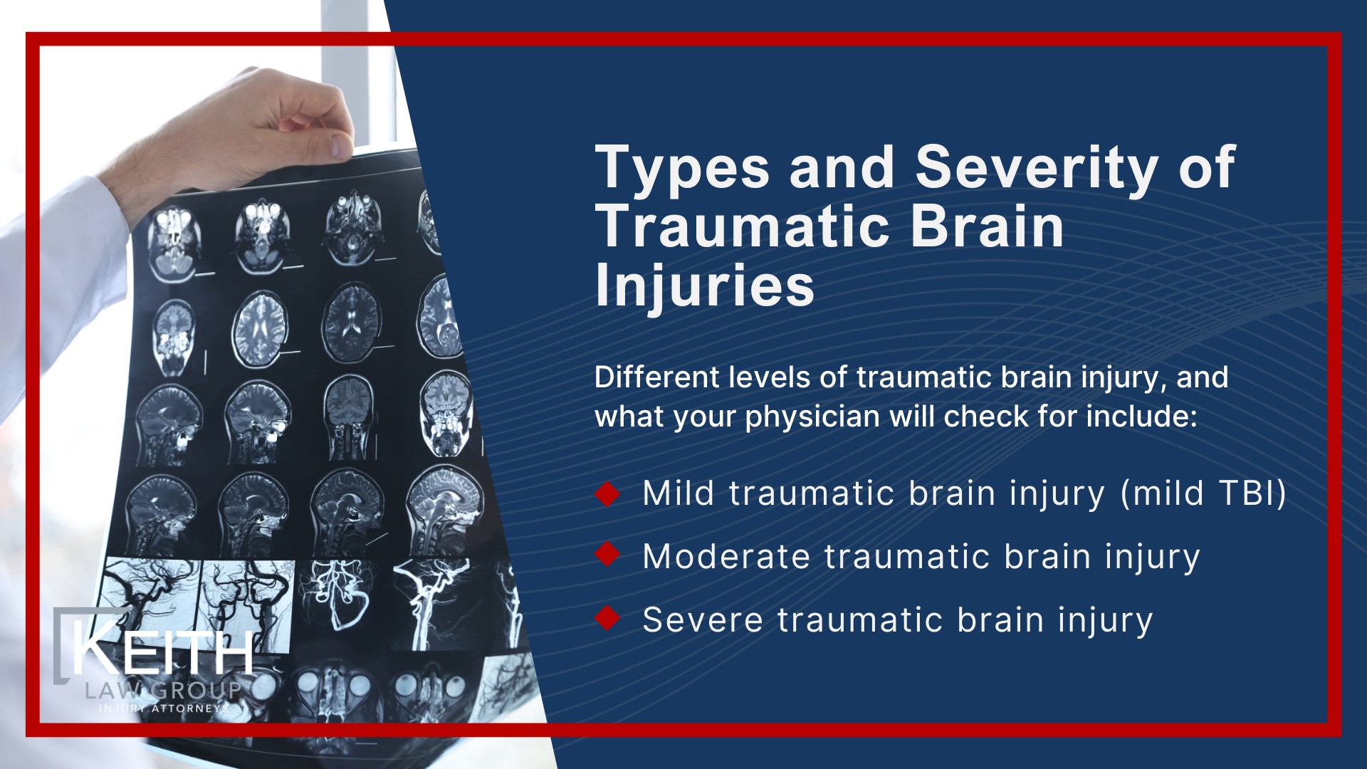 What Is a Traumatic Brain Injury (TBI); What Is a Traumatic Brain Injury (TBI); Keith Law Group_ Experienced Brain Injury Attorneys in Rogers; How Traumatic Brain Injuries Occur; Types and Severity of Traumatic Brain Injuries