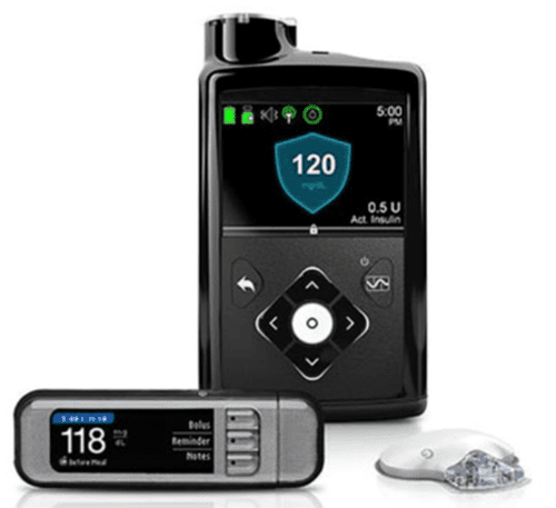 medtronic insulin pump