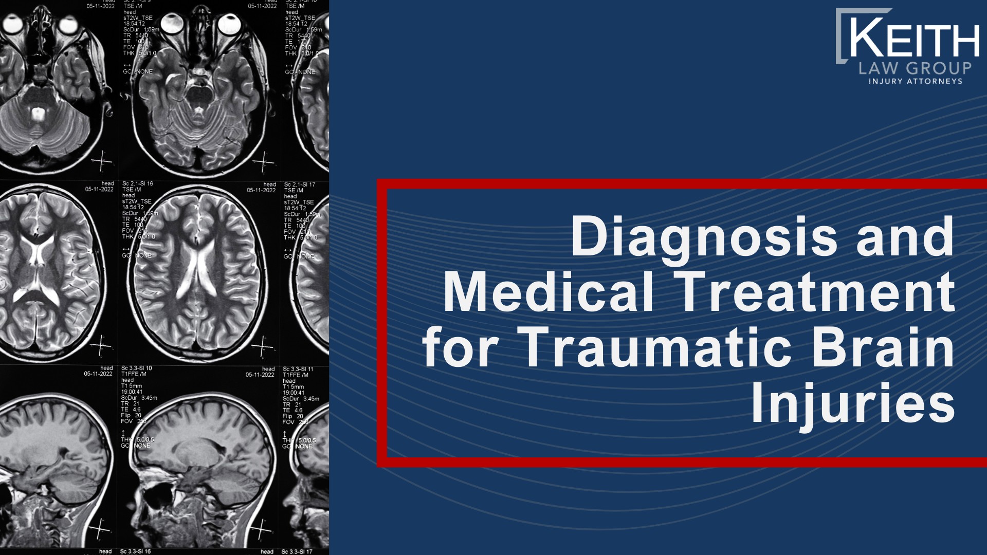 Common Causes of Traumatic Brain Injuries; Traumatic Brain Injury Symptoms ; Immediate and Short-Term Symptoms;  Cognitive, Emotional, and Behavioral Changes; Long-Term and Permanent Complications; Diagnosis and Medical Treatment for Traumatic Brain Injuries