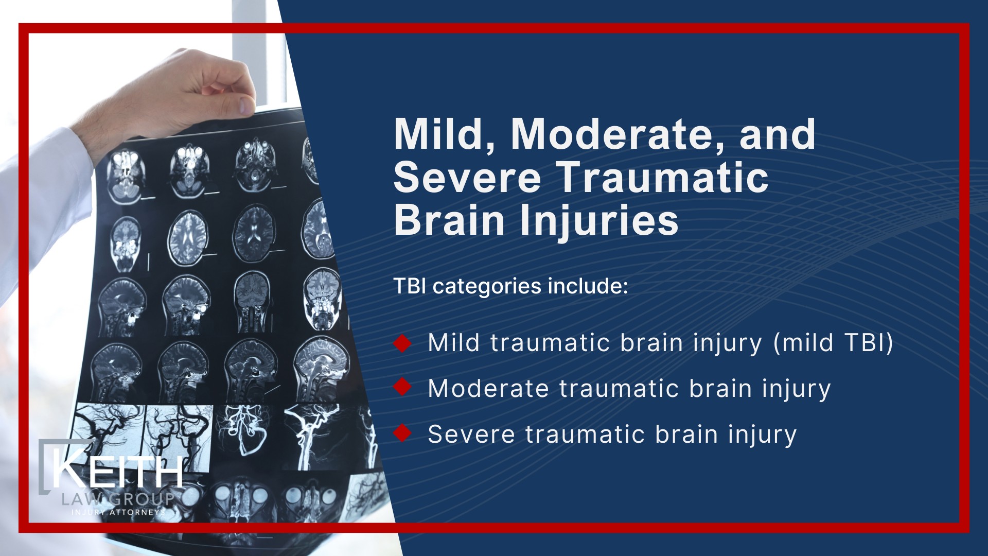 Keith Law Group_ Representation for Traumatic Brain Injury Victims in Little Rock; What Is a Traumatic Brain Injury (TBI); Mild, Moderate, and Severe Traumatic Brain Injuries